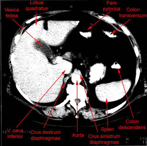 anatomia radiologiczna - 4.gif