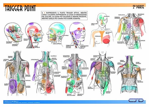 Mapy ciała - trigger point 2.jpg